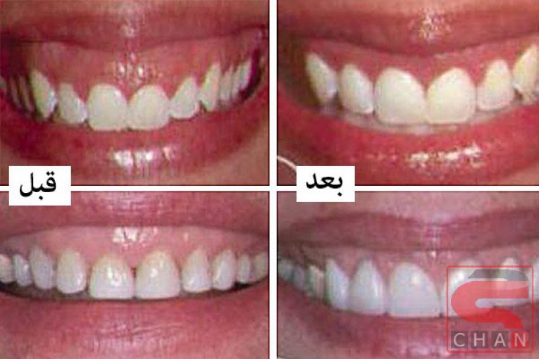 جراح لثه در رشت - دکتر شهرام جلیل زاده